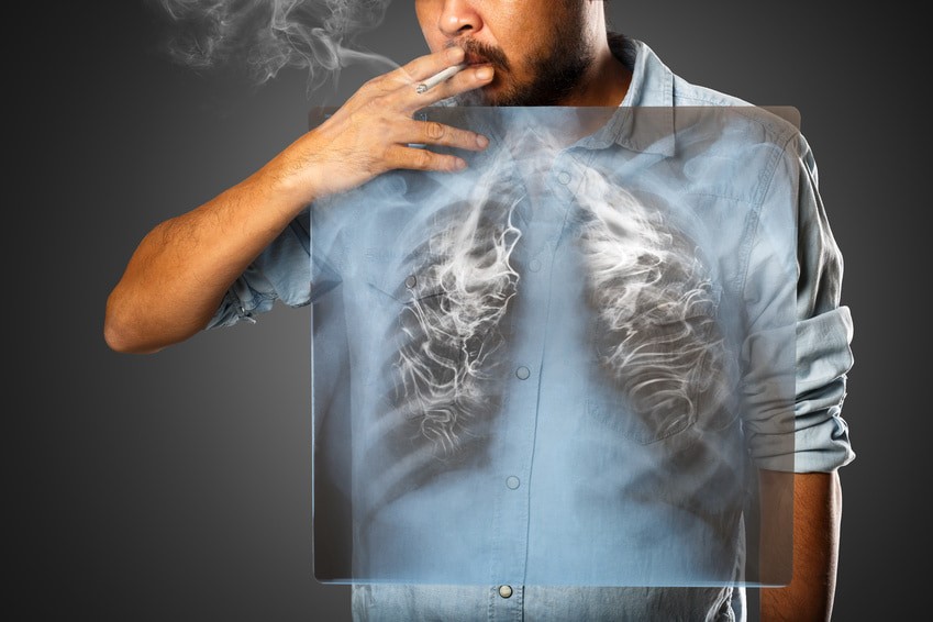 Pourquoi la cigarette est dangereuse ?